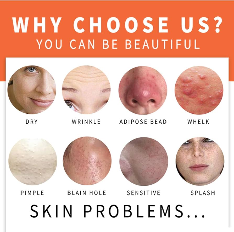 Picture of Kojie San Skin Brightening Soap - Original Kojic Soap that Reduces Dark Spots, Hyperpigmentation, & Scars with Coconut & Tea Tree Oil - 65g x 1 Bar