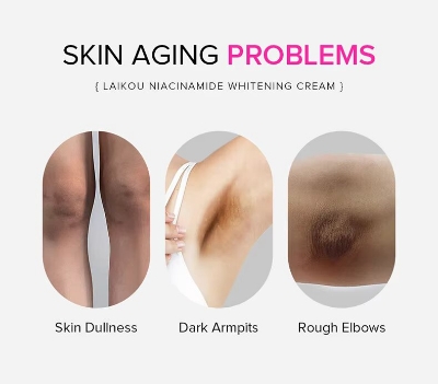 Picture of LAIKOU Niacinamide Underarm Knee darkness removing cream 100g