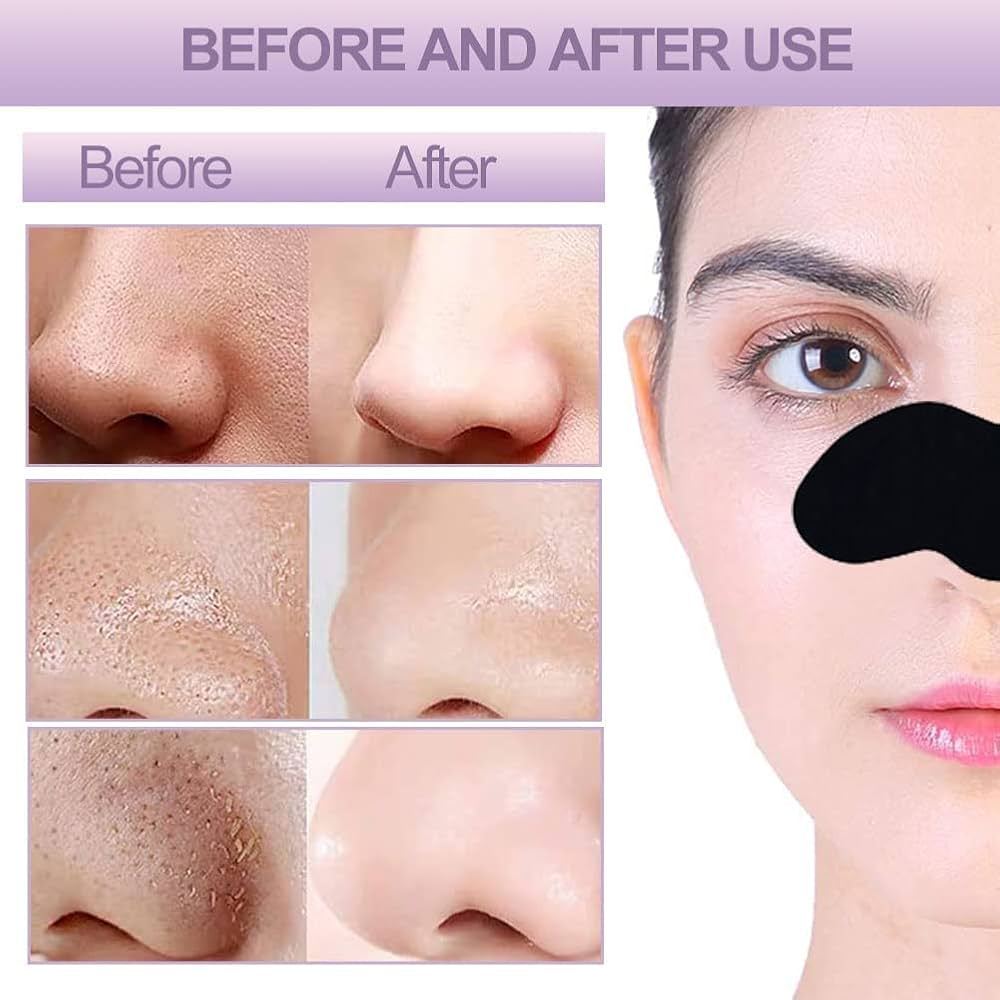 Picture of Lanbena Deep Cleansing Nose Strips 5 Pcs