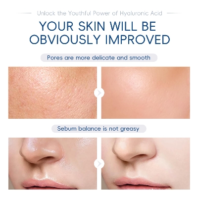 Picture of Laikou hyaluronic acid sodium hand serum 50ml