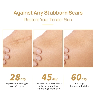 Picture of LANBENA Scar Removal Cream 40g