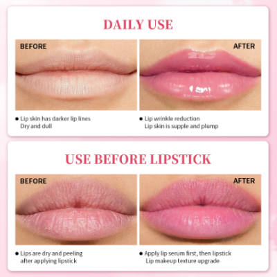 Picture of Lanbena Lip Lightening Serum Lip Plumper