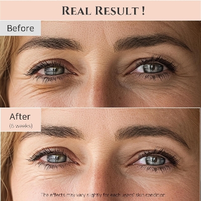 Picture of Beauty of Joseon Eye Serum