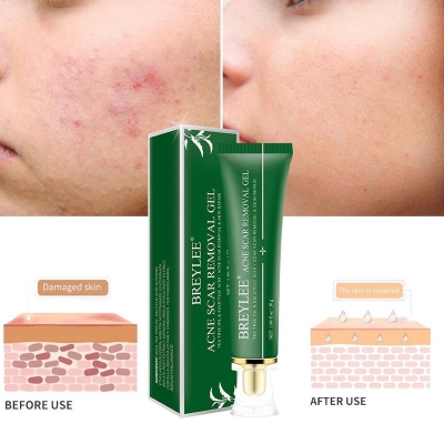 Picture of Breylee Acne & Scar Removal Gel - 30g