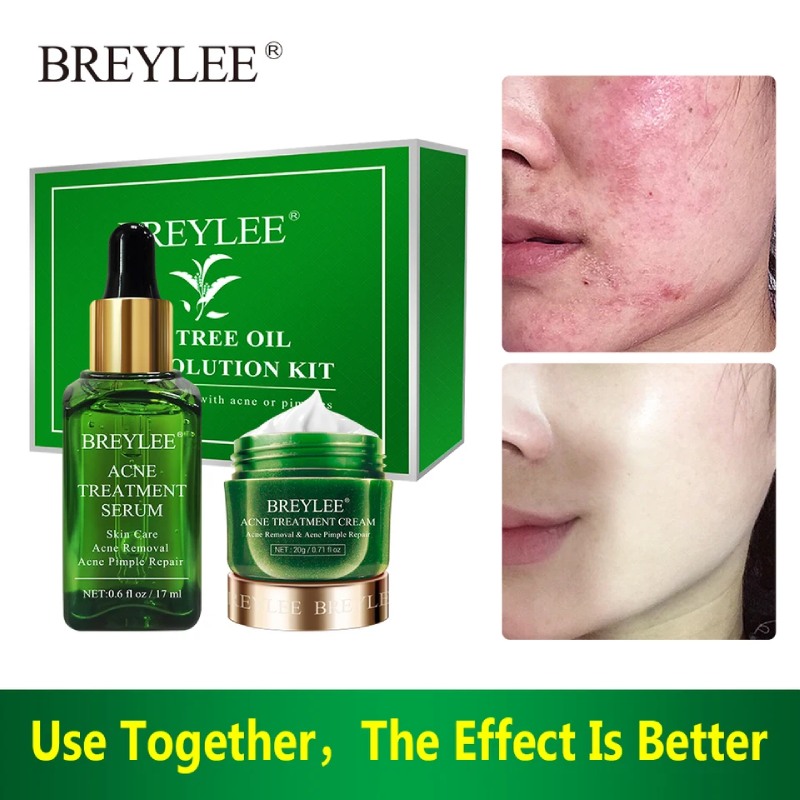 Picture of BREYLEE Acne Treatment Cream and Serum( 20g +17ml)