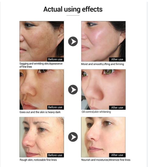 Picture of Lanbena Hyaluronic Acid Serum 15ml