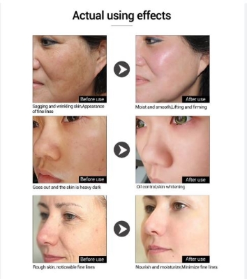 Picture of Lanbena Hyaluronic Acid Serum 15ml