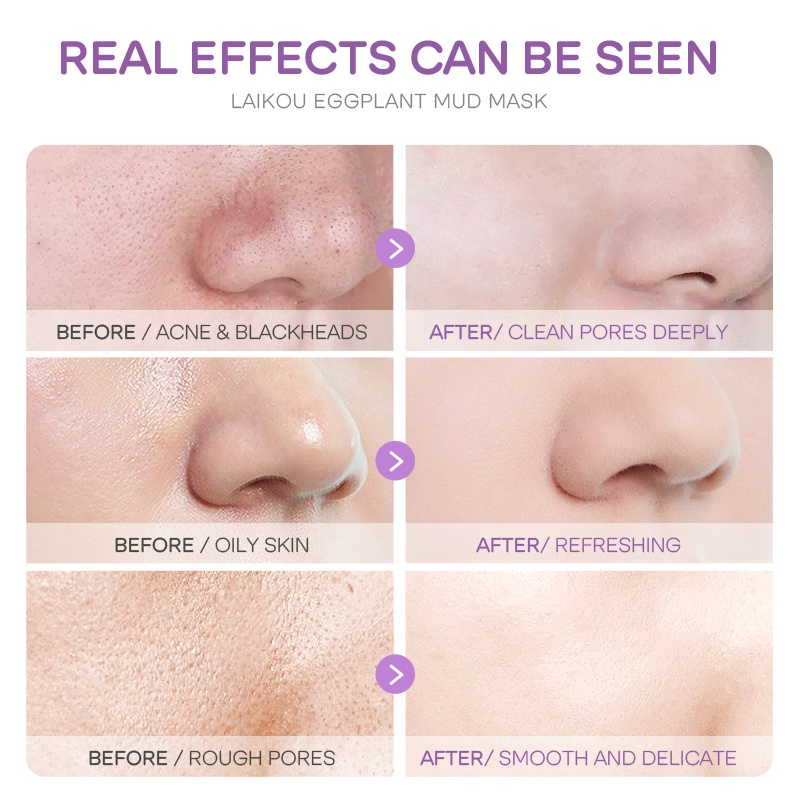 Picture of LAIKOU Eggplant Mud Mask 5gm -5pcs