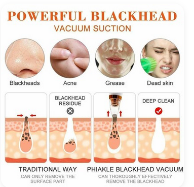 Picture of Multifunctional Cleaning Instrument, Electric Blackhead Remover Machine Vacuum Acne Cleaner Pore Remove Facial Skin Cleanser Care Multifunctional Cleaning Instrument, Blackhead Remover Multifunctional Cleaning Instrument