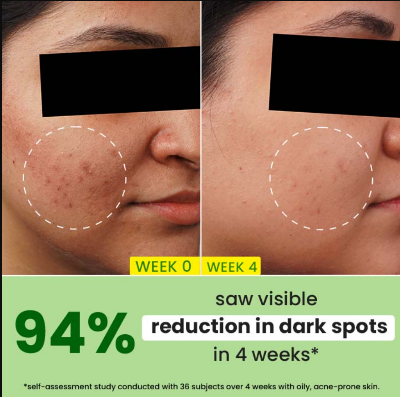 Picture of Dot & Key Cica + 10% Niacinamide Spot Reduction Face Serum (30ml)