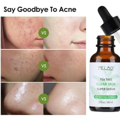 Picture of MELAO TEA TREE CLEAR SKIN SUPER SERUM-30ml