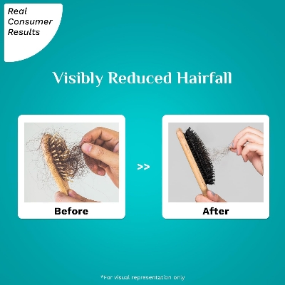 Picture of Pilgrim RootActive Anti-Hairfall Serum with Spanish Rosemary Caffeine Biotin Capilia Longa Saw Palmetto (30ml)