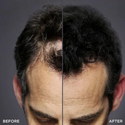 Picture of Toppik Hair Fiber Spray Applicator