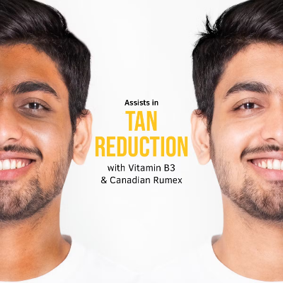 Picture of Ustraa De-Tan Cream for Men - 50g