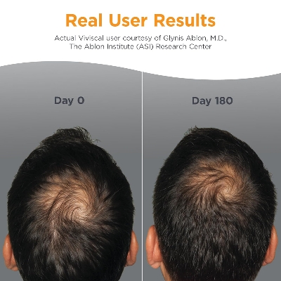 Picture of Viviscal Men's Hair Growth Supplements for Thicker Fuller Hair Clinically Proven Collagen Complex 180 Tablets 3 Month Supply