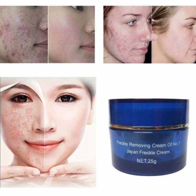 Picture of International Japanese Products Anti Freckles  Cream 25m