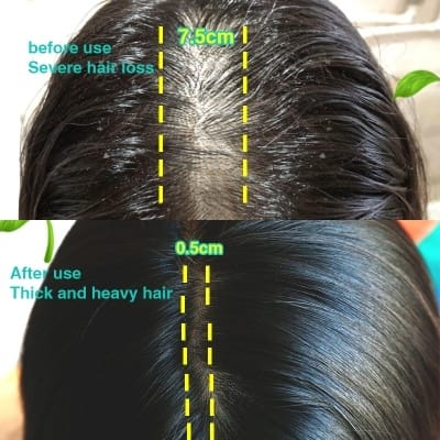 Picture of 100% Natural Ginger Hair Serum Hair Grower Fast Long Hair Treatment Minoxidil Hair Grower Castor Oil For Essence Preventing Baldness Consolidate Hair Loss Treatment repairs the hair improves hair loss hair growth serum 10 x faster