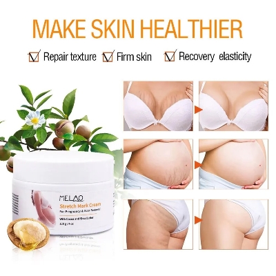 Picture of Melao Stretch Mark Cream 120g - Fresh