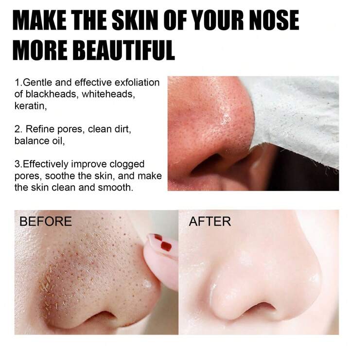 Picture of Beauty Glazed Nose Pore Strips Blackhead Acne Nose Patch To Remove Skin Care Beauty Nose Pore Strips -10 peace