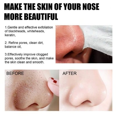 Picture of Beauty Glazed Nose Pore Strips Blackhead Acne Nose Patch To Remove Skin Care Beauty Nose Pore Strips -10 peace