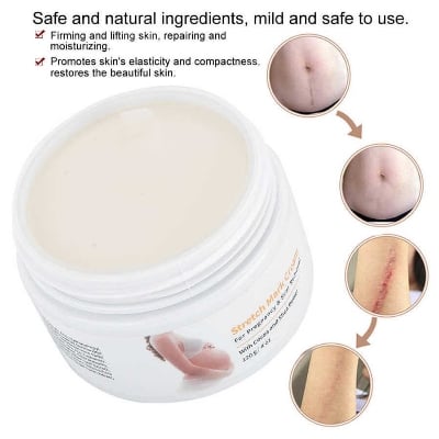 Picture of Stretch Mark Cream, Postpartum Obesity Cream, Remove Stretch Marks, Repair Scar Slack Line Abdomen Stretch Marks Postpartum 120g