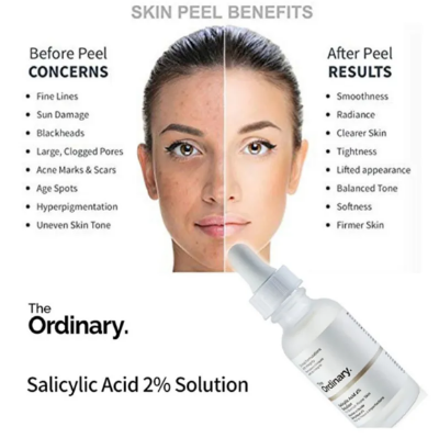Picture of Ordinary Salicylic Acid 2% Solution 30ml