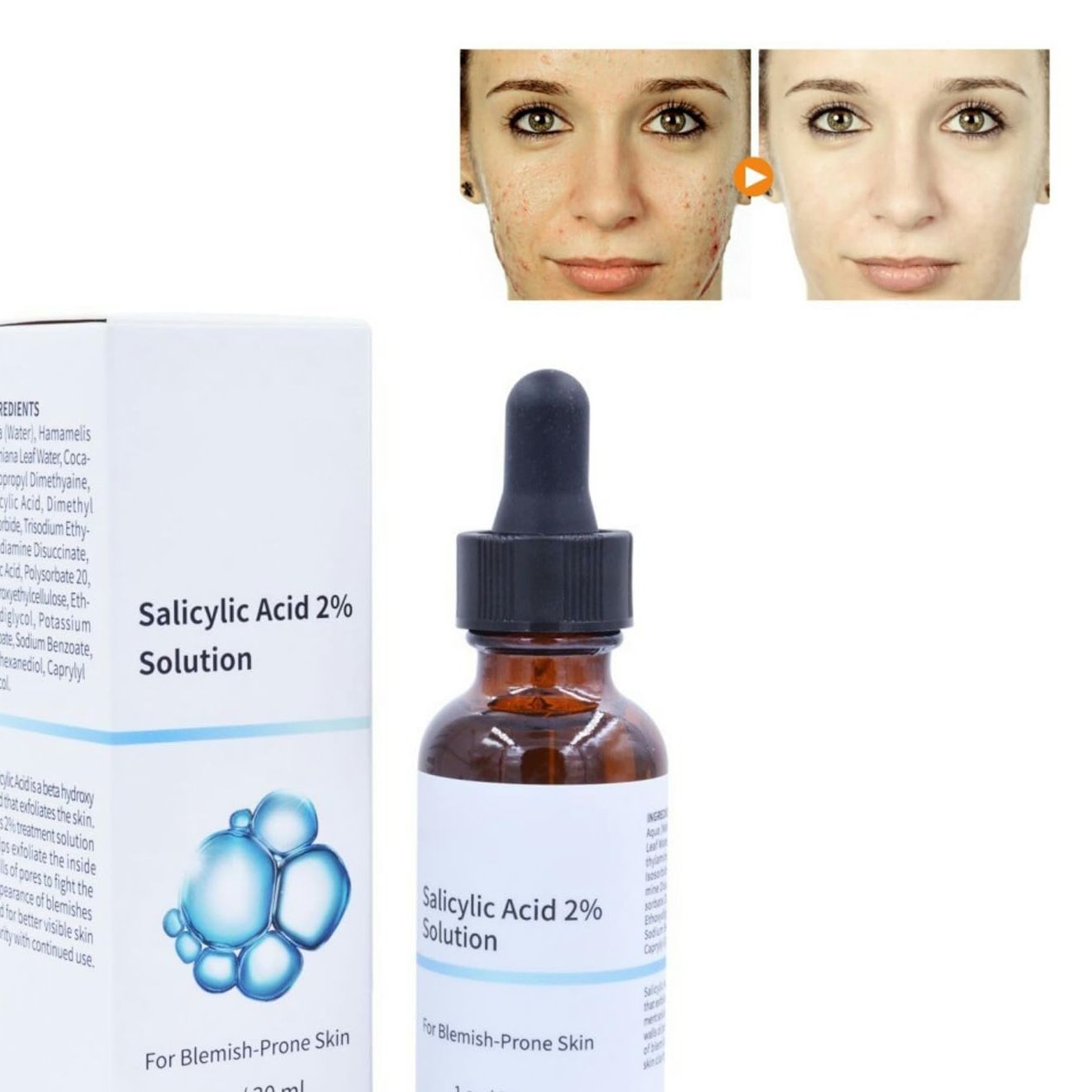 Picture of Salicylic Acid Serum 2% Concentrate - Exfoliating Solution For Face - Healing Acne Spot Treatment For Blemish Prone Skin - Professional Skincare