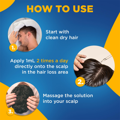 Picture of Kirkland Minoxidil 5% Topical Solution Extra Strength Hair Regrowth Treatment for Men Hair & Beard Drop + Derma Roller Free - (3 month supply) - MNXM3C