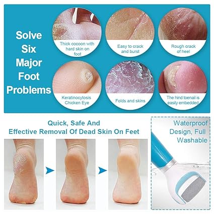 Picture of USB rechargeable electronic foot file foot pedicure tool, perfect foot cleaner, electric callus remover, used for cracked heel and dead skin, a total of 2 rolling grinding heads
