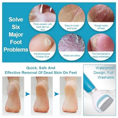 Picture of USB rechargeable electronic foot file foot pedicure tool, perfect foot cleaner, electric callus remover, used for cracked heel and dead skin, a total of 2 rolling grinding heads