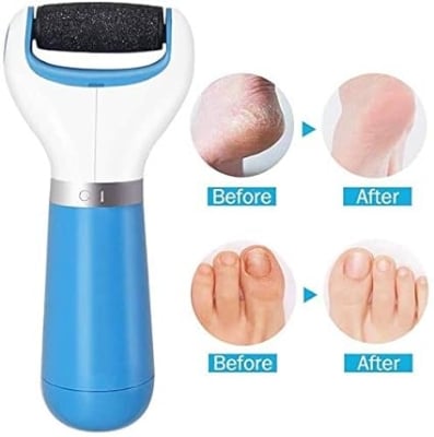 Picture of USB rechargeable electronic foot file foot pedicure tool, perfect foot cleaner, electric callus remover, used for cracked heel and dead skin, a total of 2 rolling grinding heads
