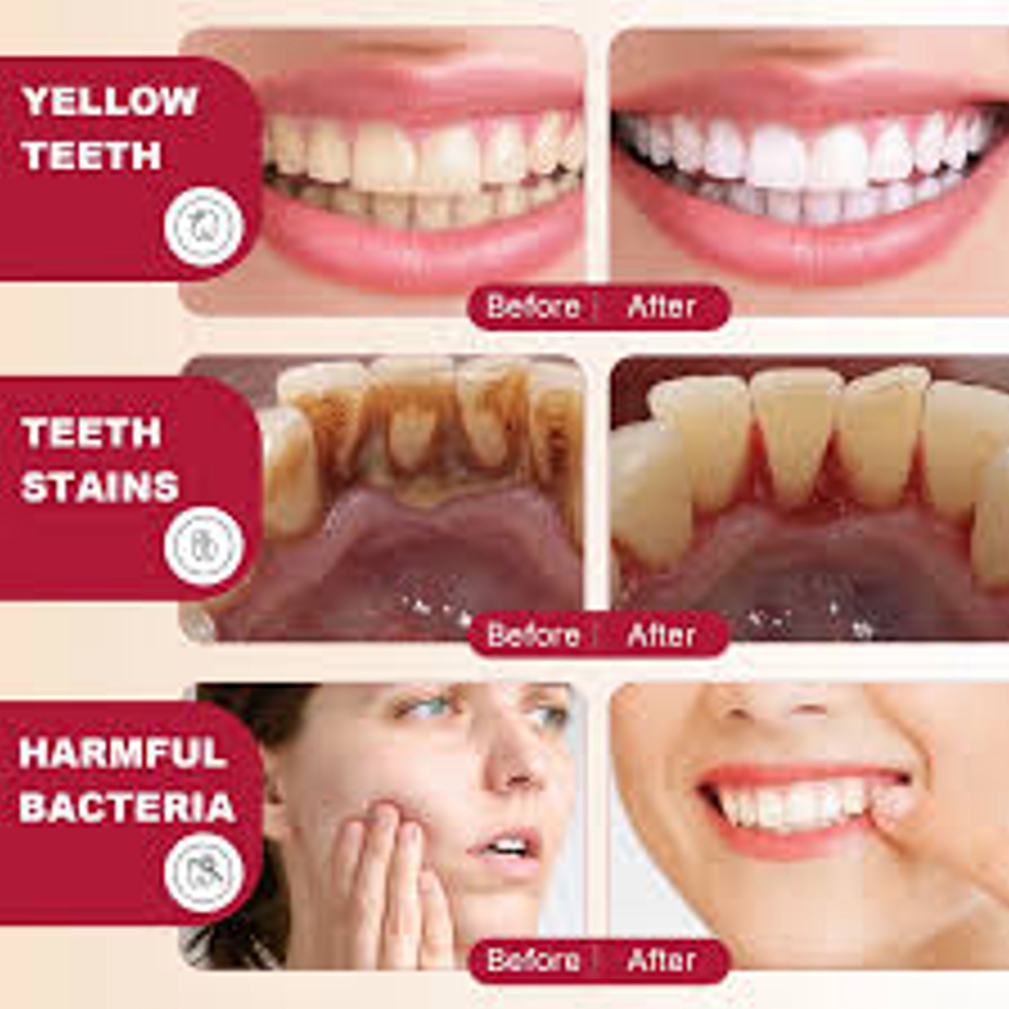 Picture of Probiotic Whitening Toothpaste (SP-4)