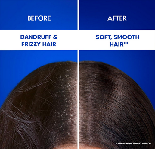 Picture of Head & Shoulders 2-in-1 Smooth and Silky Anti Dandruff Shampoo + Conditioner for Women & Men, With Almond Milk (1 L)