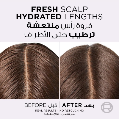 Picture of L’Oréal Paris L'OREAL Elvive Hyaluron Pure Shampoo For Oily Scalp & Dehydrated Lengths 400ml