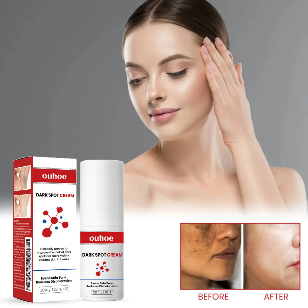 Picture of Ouhoe Dark Spot Cream 30ml