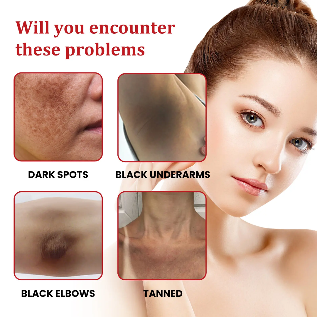 Picture of Ouhoe Dark Spot Cream 30ml
