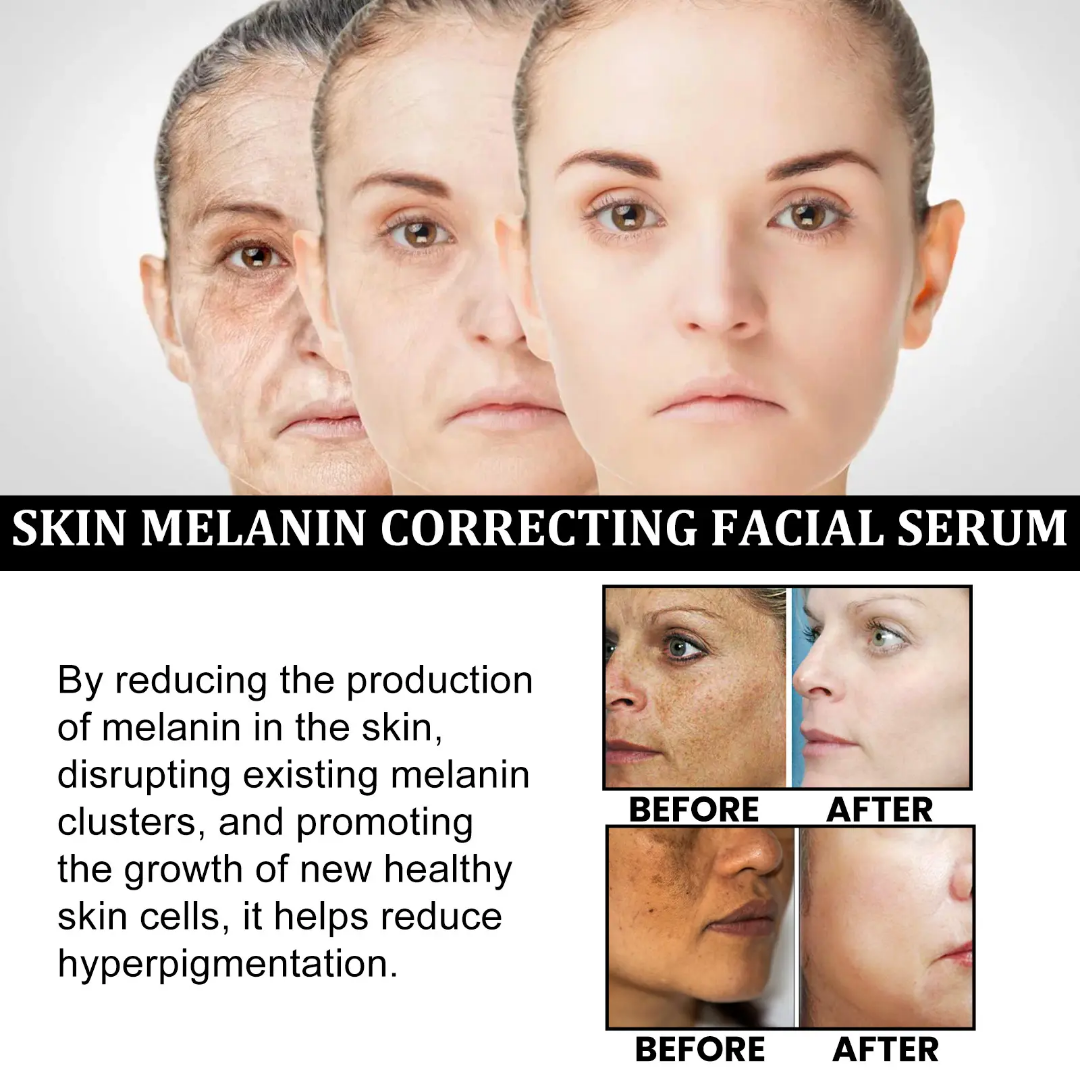 Picture of EELHOE SKIN MELANIN CORRECTING FACIAL SERUM Net: 30ml/1 fl.oz