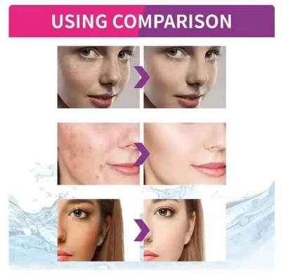 Picture of Sadoer Nicotinamide Whitening Freckle Cream 20g Lighten Dark Spots