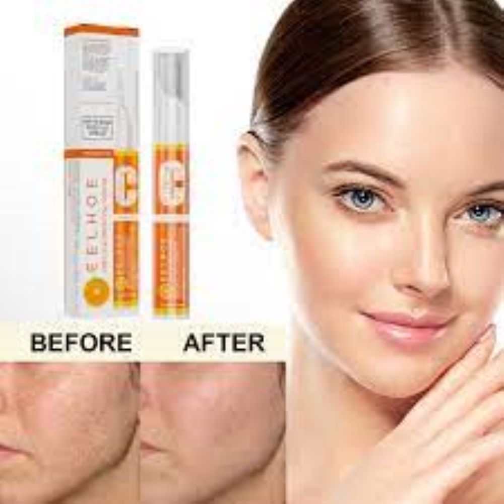 Picture of EELHOE vitamin c freckle removal whitening cream chloasma spots removing sunburn repairing hydrating whitening and freckle cream
