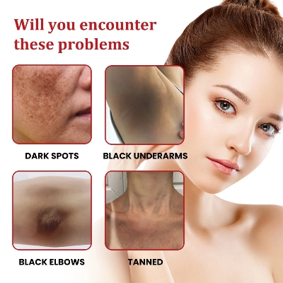 Picture of Ouhoe Dark Spot Cream 30ml