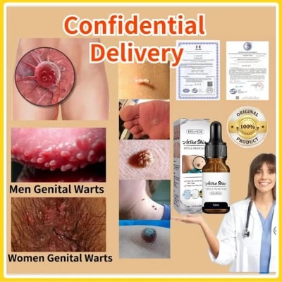 Picture of EELHOE Aclive Skin Mole Removal Essence Skin Tag Remover Mole Genital Wart Removal Antibacterial Liquid Painless Mole Skin Dark Spot Remover Serum Face Wart Tag Removal Solution 10ml