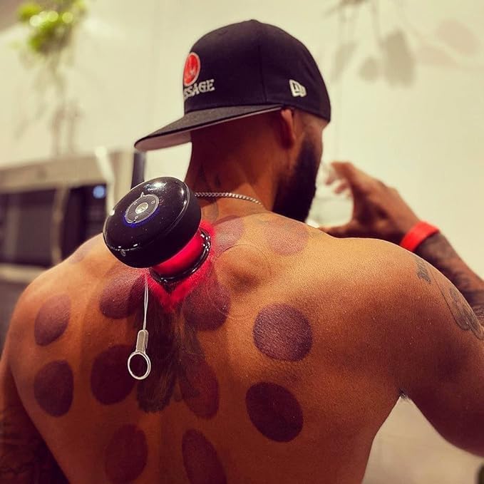 Picture of Intelligent Vacuum Cupping Massage Device Electric Heating Scraping Suction Cups Physical Fatigue Relieve Health Guasha Cans - Red