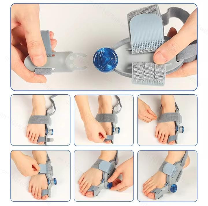 Picture of Bunion Corrector for Women & Men Big Toe: Adjustable Bunion Fix for Big Toe Separation Pain Relief - Orthopedic Bunion Splint with Straightener for Toes Alignment Hallux Valgus Correction - Light Ash