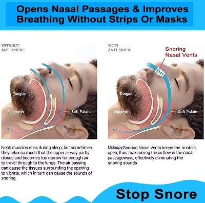 Picture of 8pc Anti-Snoring Device Prevent Snoring Sleeping Prevent Nasal Congestion Snoring Nose Clip Easy Breathe Improve Sleeping - Multicolor