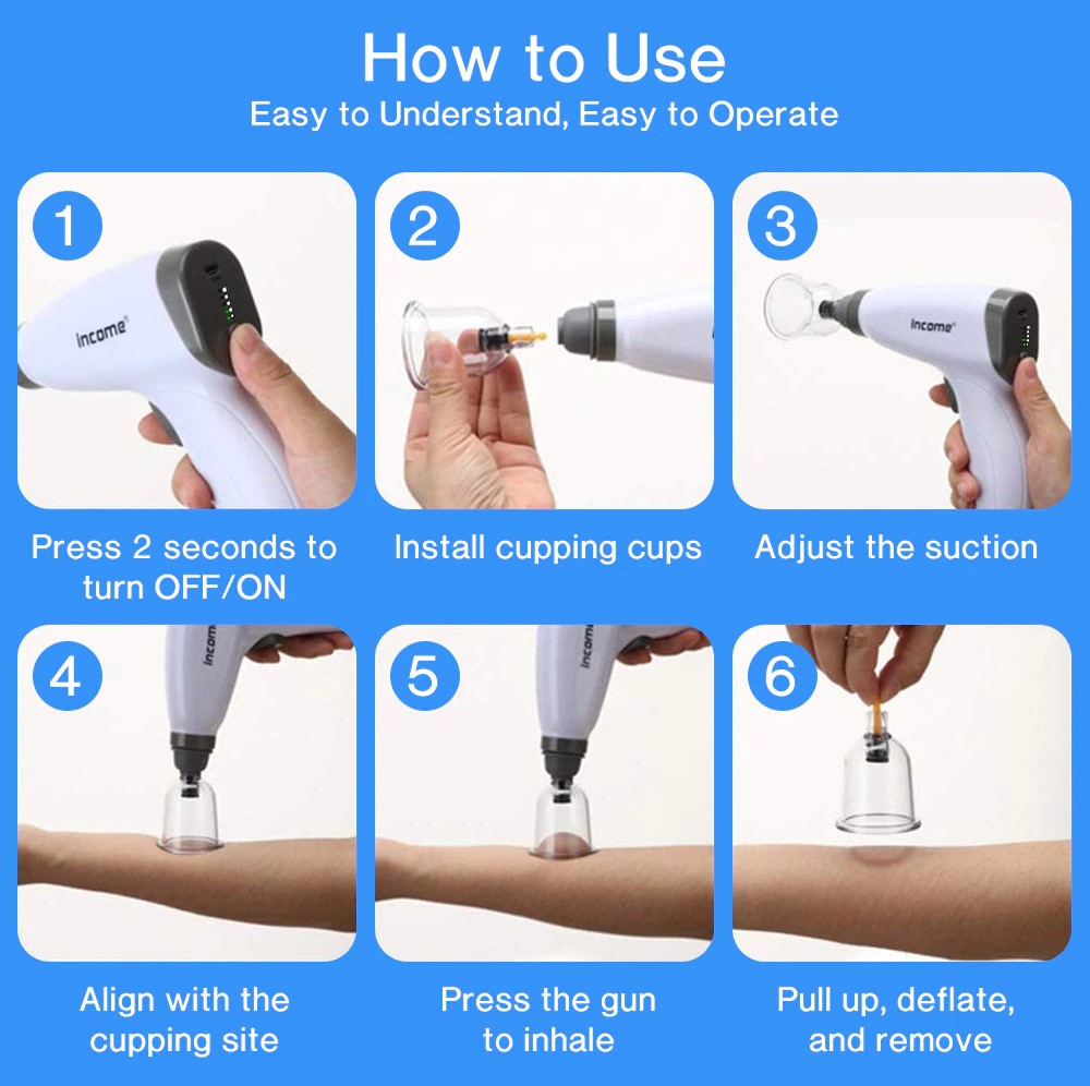Picture of Electric Vacuum Cupping Massage Set, Vacuum Massager, Cupping Therapy Set, Anti Cellulite Suction Cups, Physiotherapy Jars - Multicolor