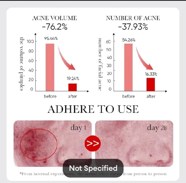 Picture of SADOER Fruit Acid AHA+BHA Acne Repair Serum-30ml - 