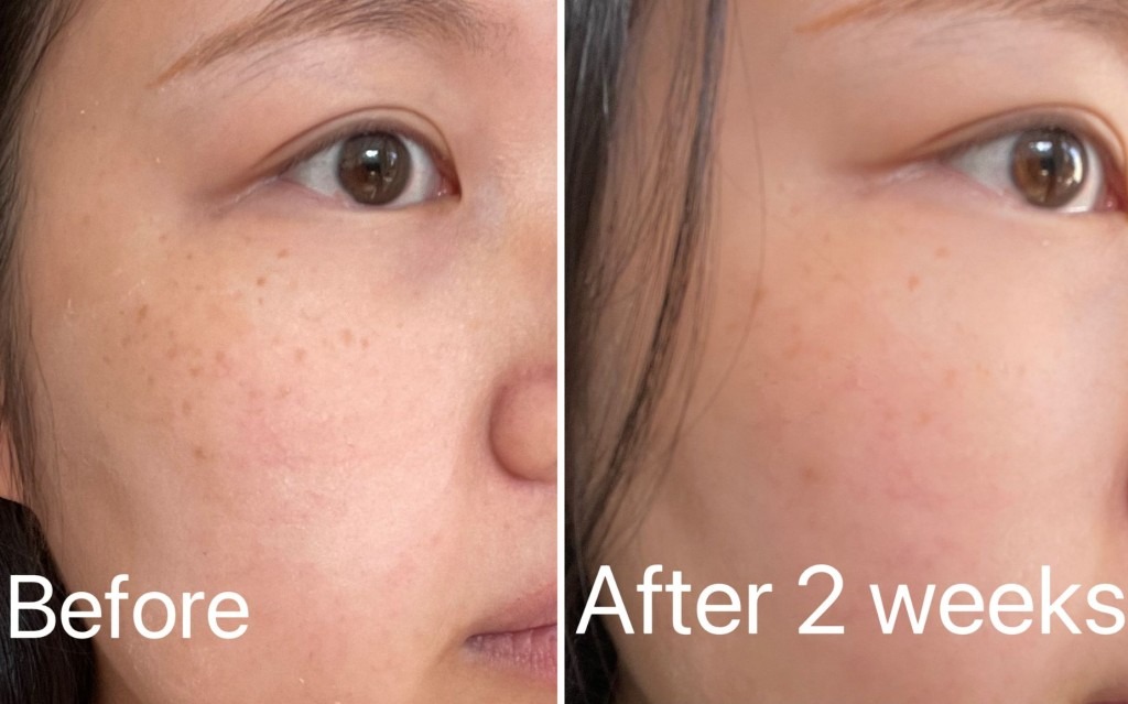 Picture of PALMER'S Skin Success with Vitamin E Anti- Dark Spot Fade Cream- 75g (All Skin Type) - 