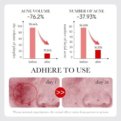 Picture of SADOER Fruit Acid AHA+BHA Acne Repair Serum- 30ml - 