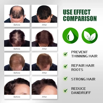 Picture of Ginger oil Hair (Oil) Growth Therapy Authentic and original 50ml