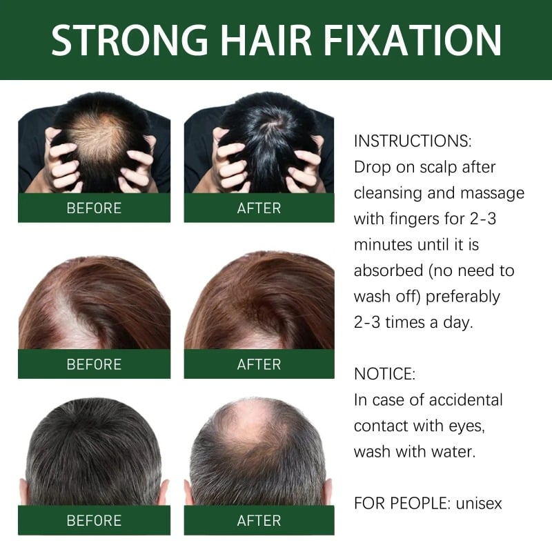 Picture of Ginger oil Hair (Oil) Growth Therapy Authentic and original 50ml